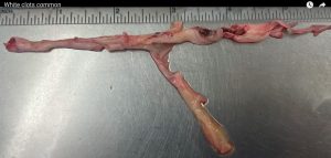 Clot