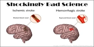 Featured Stroke